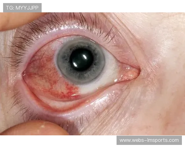 阿科斯塔视力严重受损仍坚韧完成比赛全程